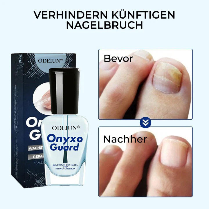 ODEIUN® OnyxoGuard Profi Wachstum der Nägel und Reparaturserum