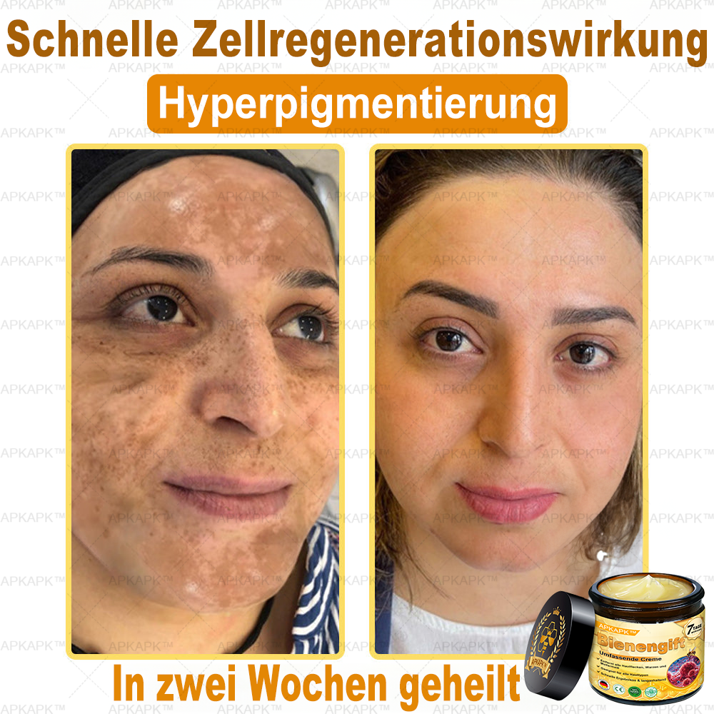 Hergestellt in Deutschland ✨✨AРKAРК™ Bienengift Umfassende Creme