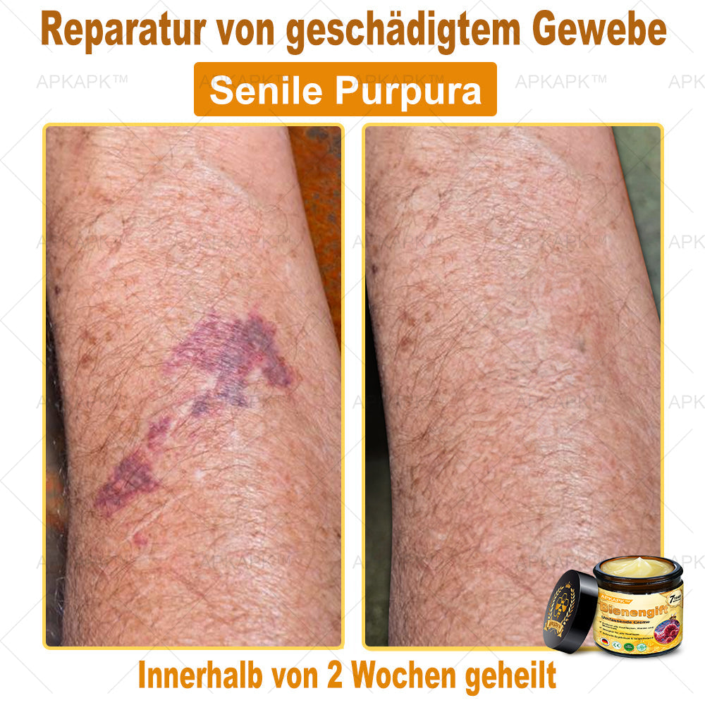 Hergestellt in Deutschland ✨✨AРKAРК™ Bienengift Umfassende Creme