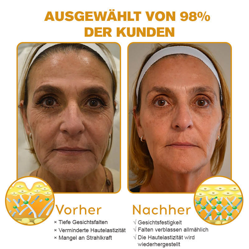 🐝🍀Hergestellt in Deutschland - ✨NEGUSY™ Botox Bienenvenom Faltenentfernungscreme