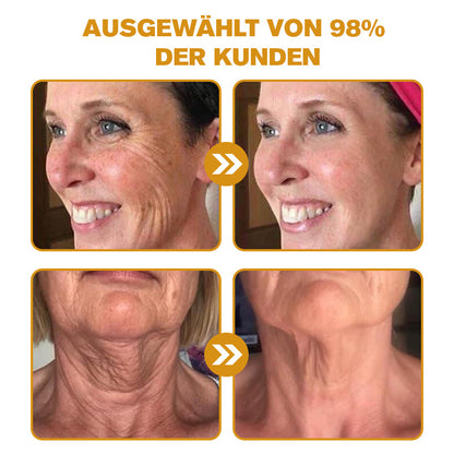 🐝🍀Hergestellt in Deutschland - ✨NEGUSY™ Botox Bienenvenom Faltenentfernungscreme