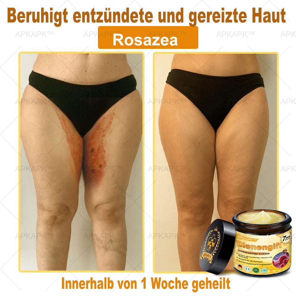 Hergestellt in Deutschland ✨✨AРKAРК™ Bienengift Umfassende Creme