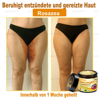 Hergestellt in Deutschland ✨✨AРKAРК™ Bienengift Umfassende Creme