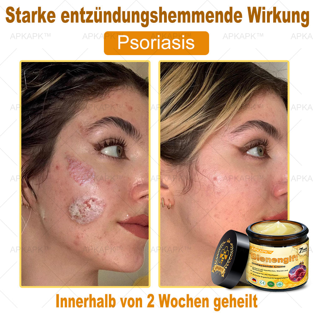 Hergestellt in Deutschland ✨✨AРKAРК™ Bienengift Umfassende Creme