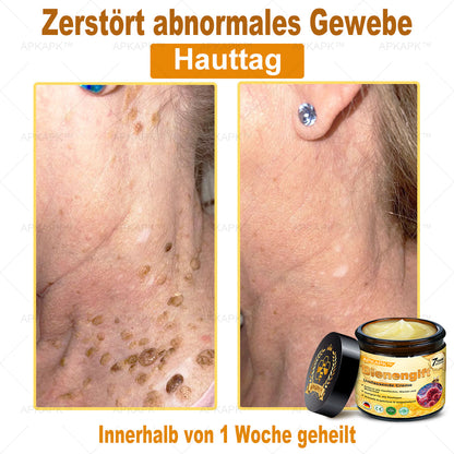 Hergestellt in Deutschland ✨✨AРKAРК™ Bienengift Umfassende Creme