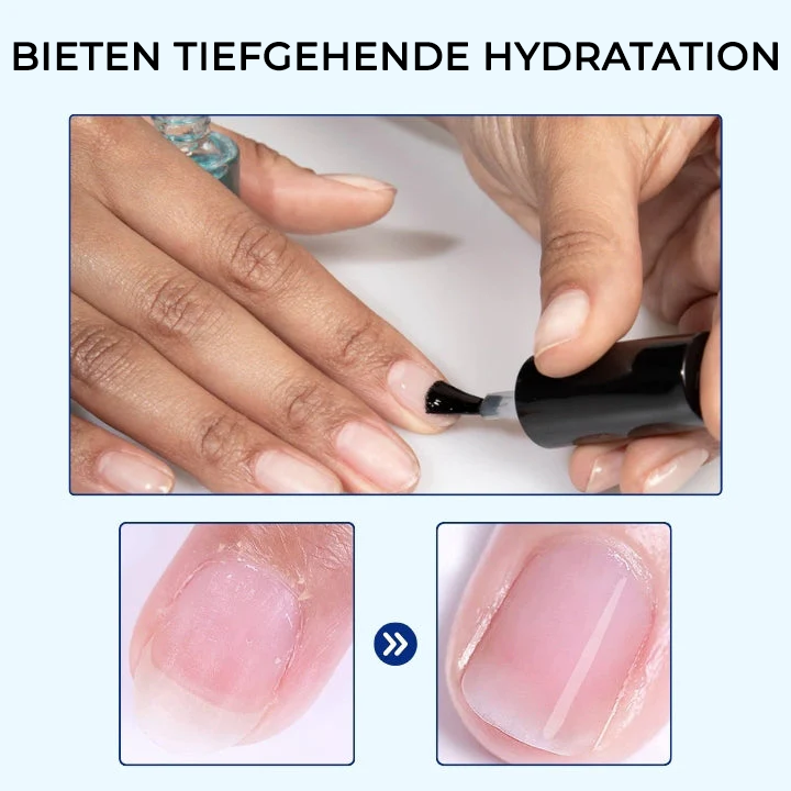 ODEIUN® OnyxoGuard Profi Wachstum der Nägel und Reparaturserum