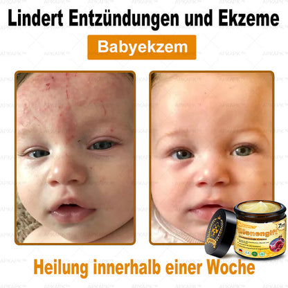 Hergestellt in Deutschland ✨✨AРKAРК™ Bienengift Umfassende Creme