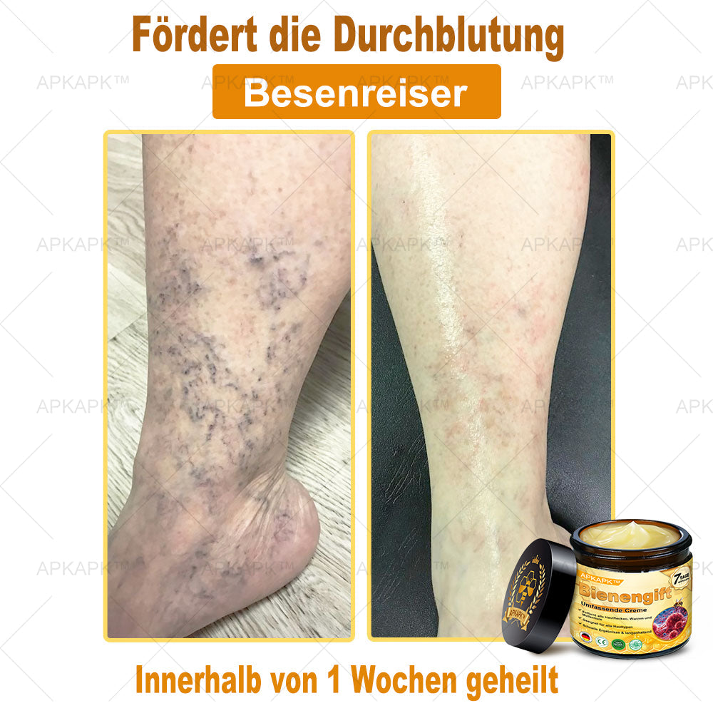 Hergestellt in Deutschland ✨✨AРKAРК™ Bienengift Umfassende Creme