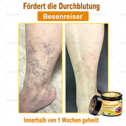 Hergestellt in Deutschland ✨✨AРKAРК™ Bienengift Umfassende Creme
