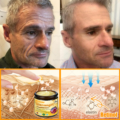 Hergestellt in Deutschland ✨✨AРKAРК™ Bienengift Umfassende Creme