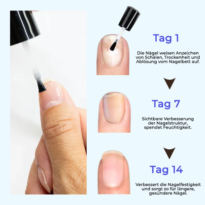 ODEIUN® OnyxoGuard Profi Wachstum der Nägel und Reparaturserum