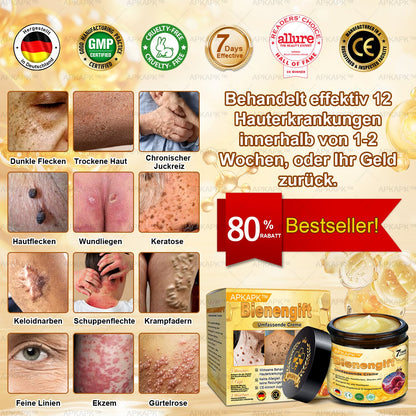 Hergestellt in Deutschland ✨✨AРKAРК™ Bienengift Umfassende Creme