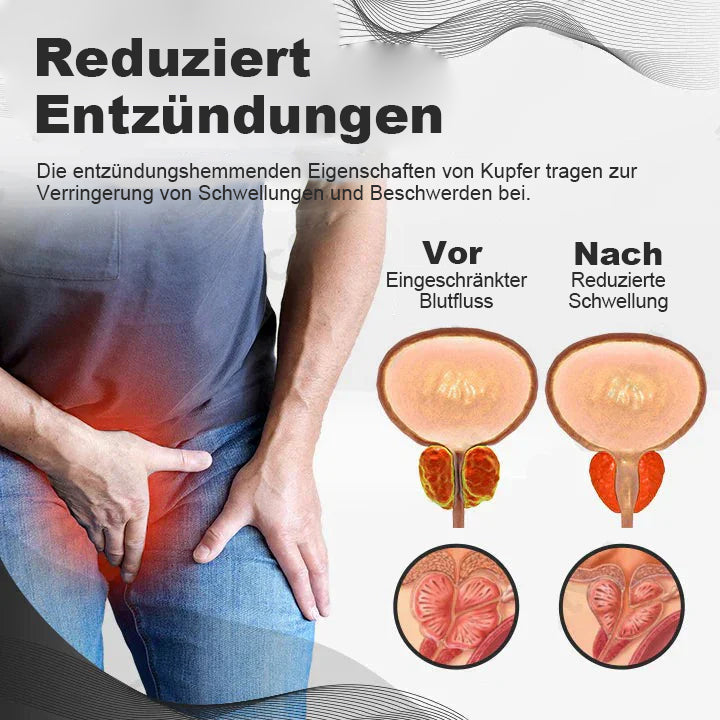 【✨Offizieller Markenshop ✨】Kupfer-Magnetisches Prostata-Therapiering (Zeitlich begrenzter Rabatt 🔥 Letzter Tag)