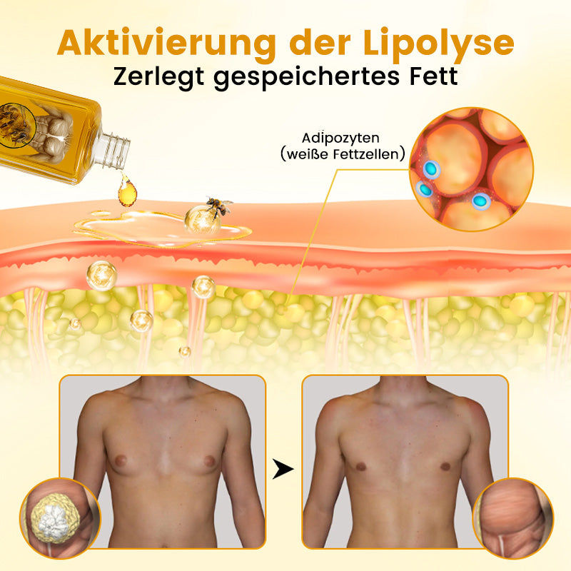 ✅💪🏻ODALIT™ ThermoFirm Bienengift Öl zur Behandlung von Gynäkomastie