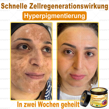 Hergestellt in Deutschland ✨✨AРKAРК™ Bienengift Umfassende Creme