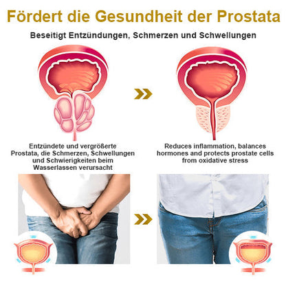 【✨Offizieller Markenshop ✨】Kupfer-Magnetisches Prostata-Therapiering (Zeitlich begrenzter Rabatt 🔥 Letzter Tag)