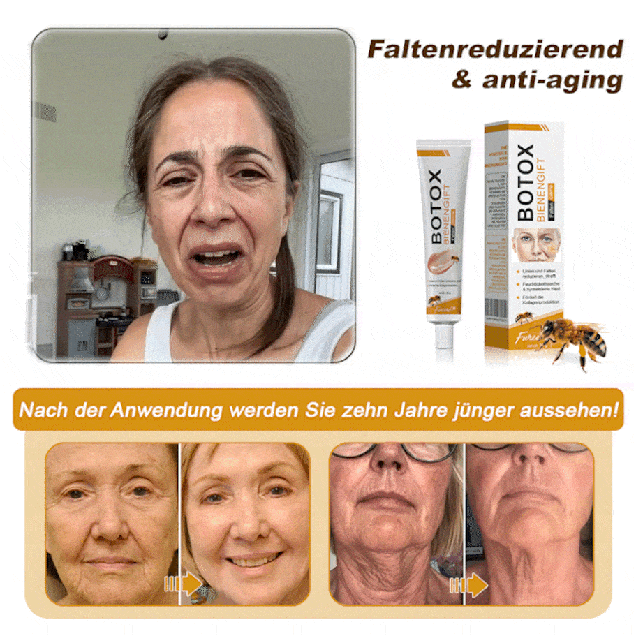 🐝🍀Hergestellt in Deutschland - ✨NEGUSY™ Botox Bienenvenom Faltenentfernungscreme