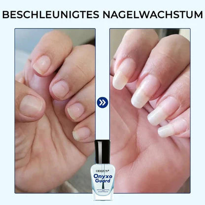 ODEIUN® OnyxoGuard Profi Wachstum der Nägel und Reparaturserum